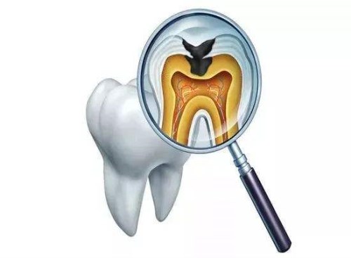 我们推荐牙痛_ 牙痛怎么治疗相关-安顺市西秀区微雅口腔诊所
