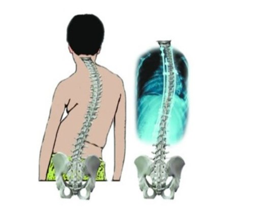 脊柱畸形矫正电话_用的舒心医药、保养-盘锦骨科医院