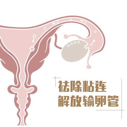菏泽左侧输卵管粘连怎么治-济南天伦不孕不育医院有限公司