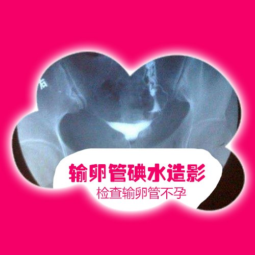 淄博妇女输卵管造影怎么做-济南天伦不孕不育医院有限公司
