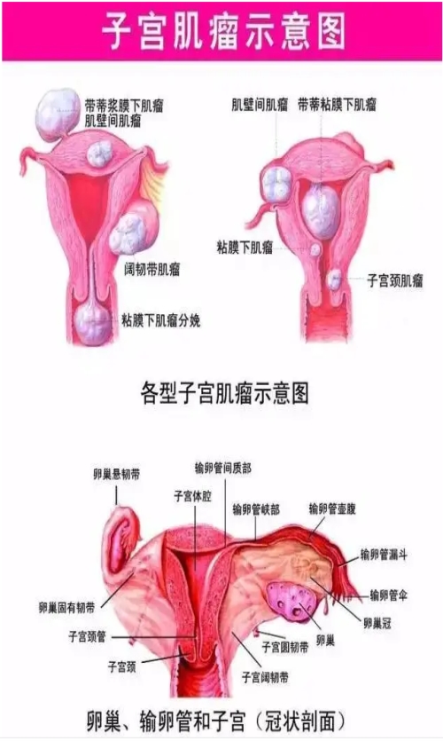 子宮肌瘤多大必須切除_子宮多發性醫療保健服務-山東舒康生物技術有限公司