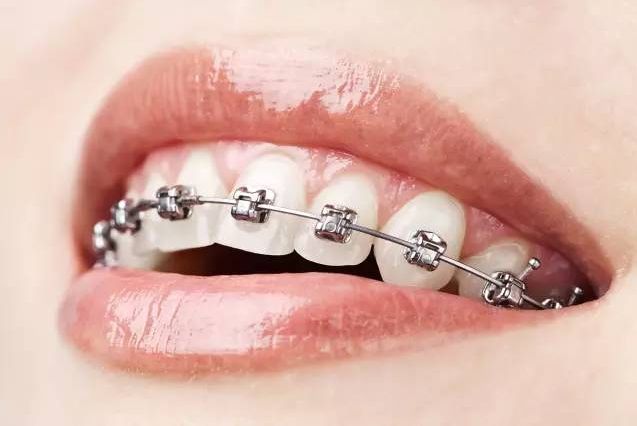 牙齒矯正診所_矯正牙齒的危害相關-成都寅鑫口腔門診部有限公司