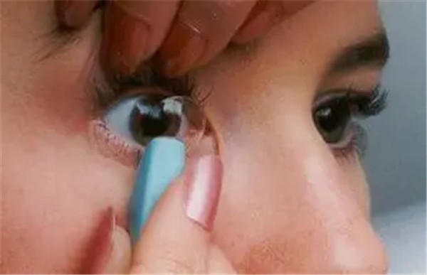 硬性透氧性角膜接触镜_角膜塑形镜品牌相关-鞍山博爱眼科医院